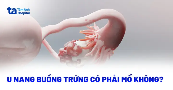 Cá Trứng Có Phải Mổ Không Và Cách Sơ Chế Đúng Cho Từng Món Ăn Cá Trứng Có Phải Mổ Không Và Cách Sơ Chế Đúng Cho Từng Món Ăn