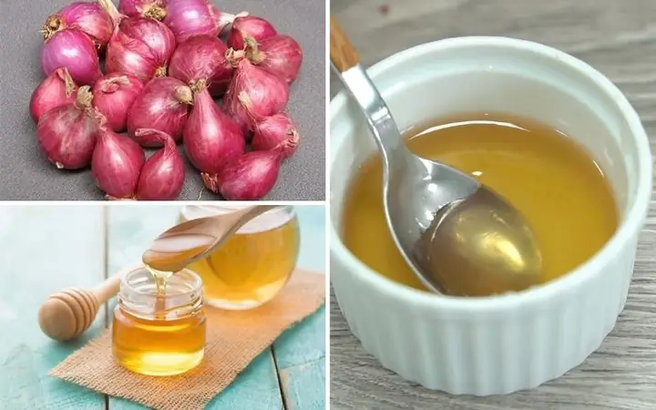 Cách Làm Hành Tím Trộn Mật Ong Trị Ho Cho Bé Và Người Lớn