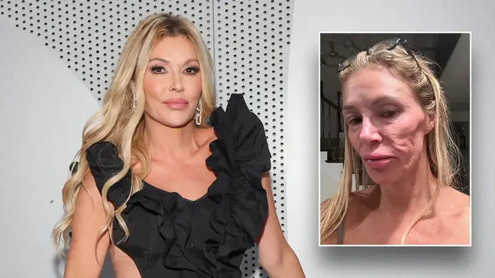 Brandi Glanville: Cập Nhật Sức Khỏe Mới Nhất, Sự Nghiệp & Scandal Nổi Bật Của Sao Real Housewives Brandi Glanville: Cập Nhật Sức Khỏe Mới Nhất, Sự Nghiệp & Scandal Nổi Bật Của Sao Real Housewives
